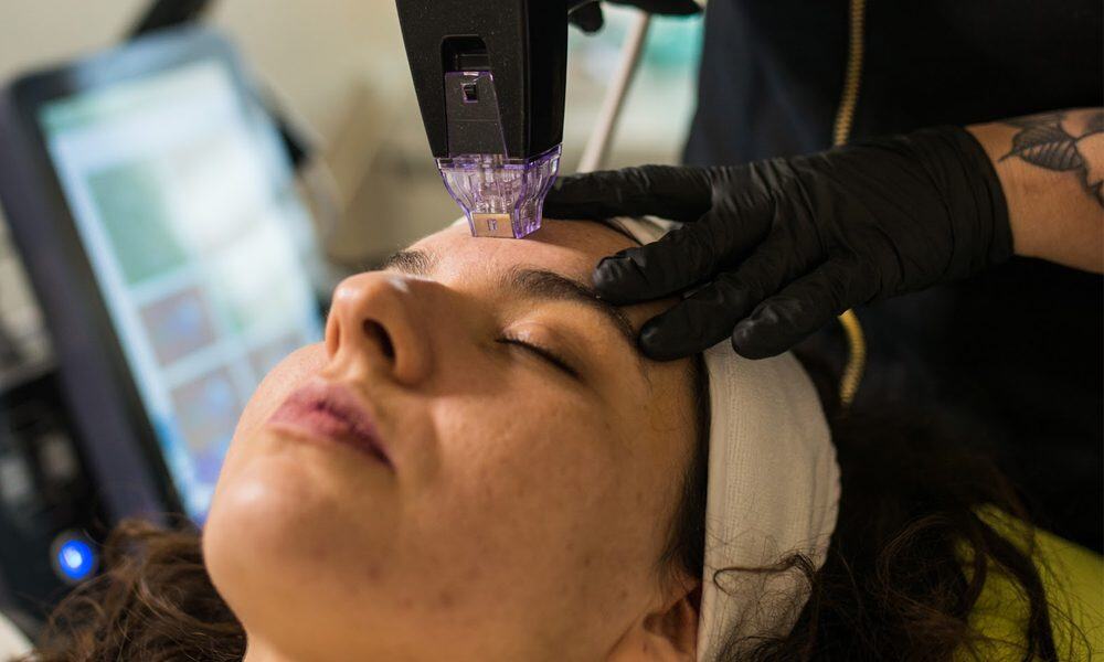 radiofrecuencia-rostro-completo